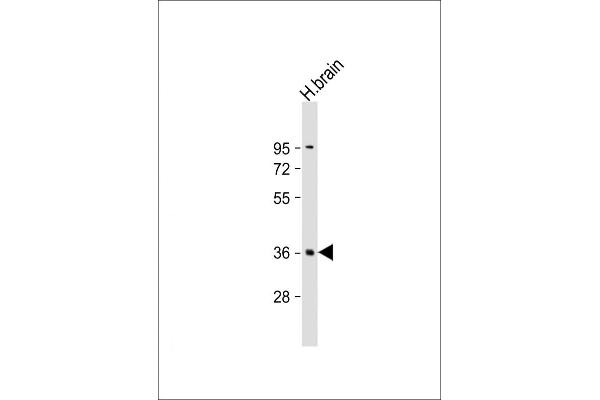 PLK5 anticorps  (AA 140-174)