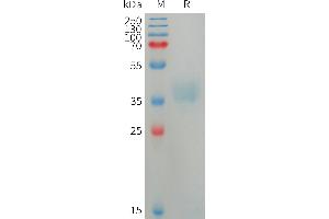 Human Protein, His Tag on SDS-PAGE under reducing condition. (Azurocidin Protein (AA 27-248) (His tag))