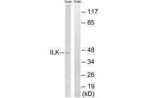 Western blot analysis of extracts from rat liver cells, using ILK (Ab-246) antibody. (ILK anticorps  (Ser246))