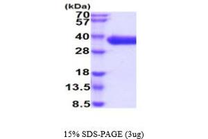 SDS-PAGE (SDS) image for CD84 (CD84) (AA 22-225) protein (His tag) (ABIN5854844) (CD84 Protein (CD84) (AA 22-225) (His tag))