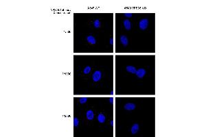 Immunocytochemistry/Immunofluorescence analysis using Mouse Anti-VPS35 Monoclonal Antibody, Clone 8A3 (ABIN6932968). (VPS35 anticorps  (Biotin))