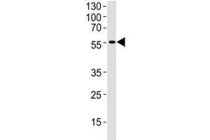 Western blot analysis of human brain tissue lysate using DCX antibody at 1:1000. (Doublecortin anticorps  (AA 107-137))