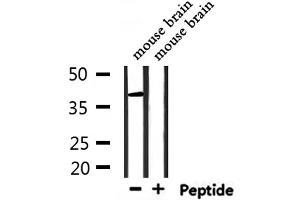 RNF167 anticorps  (Internal Region)