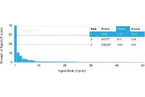 Analysis of Protein Array containing more than 19,000 full-length human proteins using CD20 Mouse Recombinant Monoclonal Antibody (MS4A1/3410). (CD20 anticorps  (AA 213-297))