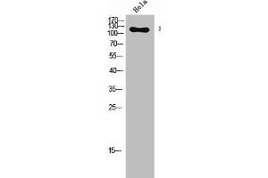 Western Blot analysis of Hela cells using Phospho-Flg (Y654) Polyclonal Antibody (FGFR1 anticorps  (pTyr654))