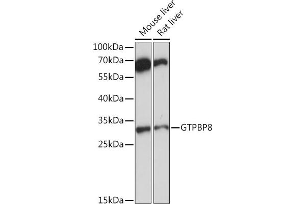 GTPBP8 anticorps  (AA 1-170)