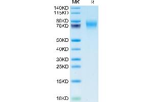 Biotinylated Human FGFR2 alpha (IIIc) on Tris-Bis PAGE under reduced condition. (FGFR2 alpha (AA 22-377) protein (His-Avi Tag,Biotin))