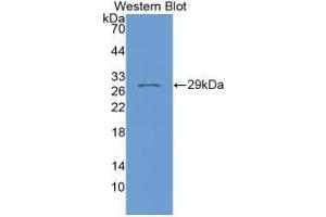 Western blot analysis of recombinant Human FKBP8. (FKBP8 anticorps  (AA 93-339))