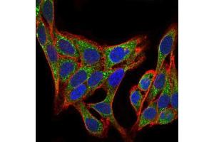 Immunofluorescence (IF) image for anti-Phosphoinositide 3 Kinase, p85 alpha (PI3K p85a) (AA 159-388) antibody (ABIN1098111)