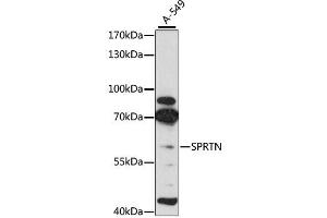 Western blot analysis of extracts of A-549 cells, using SPRTN antibody (ABIN4905287) at 1:3000 dilution. (Spartan anticorps)