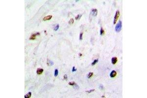 Immunohistochemical analysis of QKI staining in mouse brain formalin fixed paraffin embedded tissue section. (QKI anticorps)