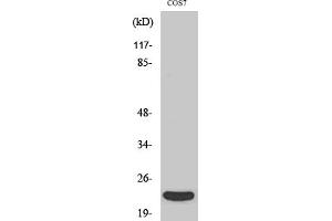 Western Blot analysis of various cells using TNF-β Polyclonal Antibody diluted at 1:1000. (LTA anticorps  (Internal Region))