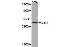 Western blot analysis of extracts of K562 cell lines, using CD83 antibody. (CD83 anticorps  (AA 20-144))