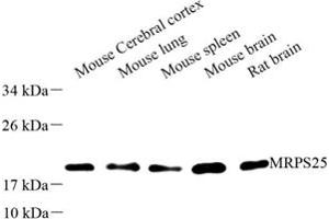 Western blot analysis of MRPS25 (ABIN7074653) at dilution of 1: 500 (MRPS25 anticorps)