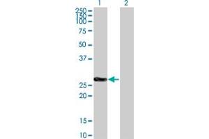 Western Blot analysis of CDKN1B expression in transfected 293T cell line by CDKN1B monoclonal antibody (M02), clone 2F4. (CDKN1B anticorps  (AA 100-198))