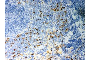 Anti- CD36 Picoband antibody, IHC(P) IHC(P): Rat Spleen Tissue (CD36 anticorps  (N-Term))
