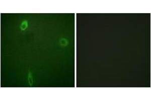 Immunofluorescence analysis of A549 cells, using ROMK/Kir1. (KCNJ1 anticorps  (pSer44))