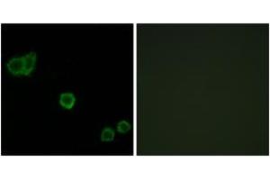 Immunofluorescence analysis of HeLa cells, using CPI17 alpha (Ab-38) Antibody. (CPI-17 anticorps  (AA 5-54))