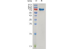 Human SPARC Protein, hFc Tag on SDS-PAGE under reducing condition. (SPARC Protein (Fc Tag))