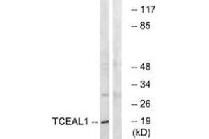 Western blot analysis of extracts from COLO cells, using TCEAL1 Antibody. (TCEAL1 anticorps  (AA 91-140))