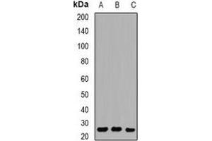 Western blot analysis of RAB27 expression in Hela (A), U937 (B), Jurkat (C) whole cell lysates. (RAB27A anticorps)