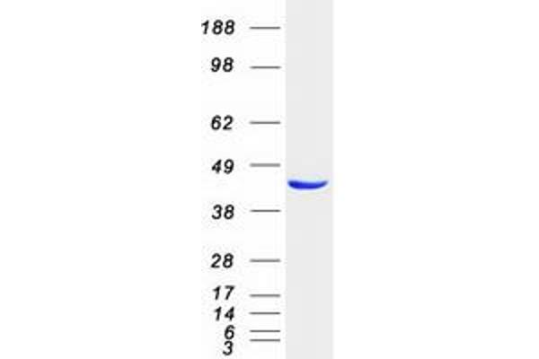 ACOT1 Protein (Myc-DYKDDDDK Tag)