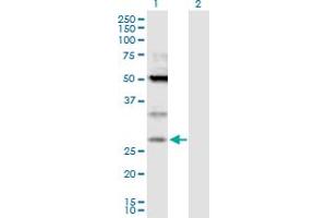Western Blot analysis of TPD52 expression in transfected 293T cell line by TPD52 MaxPab polyclonal antibody. (TPD52 anticorps  (AA 1-184))