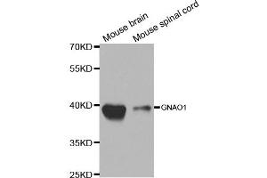 Western blot analysis of extracts of various cell lines, using GNAO1 antibody. (GNAO1 anticorps)