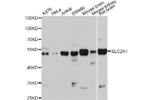 Western blot analysis of extracts of various cell lines, using SLC2A1 antibody (ABIN2559969) at 1:1000 dilution. (GLUT1 anticorps)