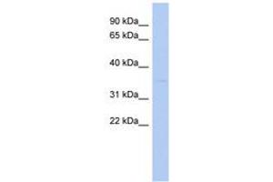 Image no. 1 for anti-STIP1 Homology and U-Box Containing Protein 1 (STUB1) (N-Term) antibody (ABIN6743148) (STUB1 anticorps  (N-Term))