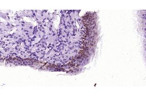 Paraformaldehyde-fixed, paraffin embedded rat bladder, Antigen retrieval by boiling in sodium citrate buffer (pH6) for 15min, Block endogenous peroxidase by 3% hydrogen peroxide for 30 minutes, Blocking buffer (normal goat serum) at 37°C for 20min, Antibody incubation with , Unconjugated  at 1:400 overnight at 4°C, followed by a conjugated secondary and DAB staining. (Ccl26 Signal Peptide (AA 1-70) anticorps)