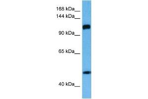 Host:  Rabbit  Target Name:  IFIH1  Sample Tissue:  Human Esophagus Tumor lysates  Antibody Dilution:  1ug/ml (IFIH1 anticorps  (Middle Region))