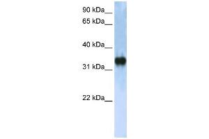 Western Blotting (WB) image for anti-Zinc Finger, CCHC Domain Containing 17 (ZCCHC17) antibody (ABIN2458243) (ZCCHC17 anticorps)
