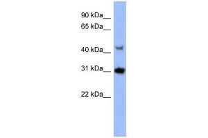 PRKY antibody used at 1 ug/ml to detect target protein. (PRKY anticorps  (N-Term))