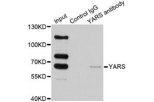 Immunoprecipitation analysis of 200 μg extracts of HeLa cells using 1 μg YARS antibody (ABIN5974115). (YARS anticorps)