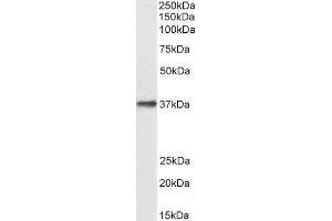 ABIN2562305 (0. (DARC anticorps  (N-Term))