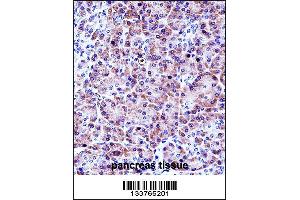 CELA3A Antibody immunohistochemistry analysis in formalin fixed and paraffin embedded human pancreas tissue followed by peroxidase conjugation of the secondary antibody and DAB staining. (Elastase 3A anticorps  (AA 157-186))