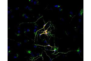 Immunofluorescence (IF) image for anti-Tubulin, beta 3 (TUBB3) (N-Term) antibody (ABIN93911)