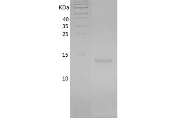 Leptin Protein (LEP) (AA 22-167) (His tag)