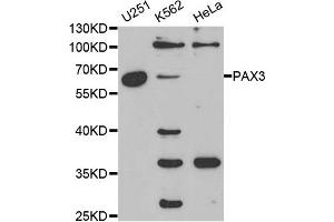 Western blot analysis of extracts of various cell lines, using PAX3 antibody. (Paired Box 3 anticorps)