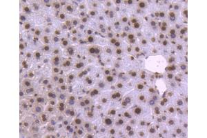 Paraformaldehyde-fixed, paraffin embedded mouse liver, Antigen retrieval by boiling in sodium citrate buffer (pH6) for 15min, Block endogenous peroxidase by 3% hydrogen peroxide for 30 minutes, Blocking buffer (normal serum) at 37°C for 20min, Antibody incubation with Histone H2B (3A6) Monoclonal Antibody  at 1:50 overnight at 4°C, followed by a conjugated secondary and DAB staining. (Histone H2B anticorps)