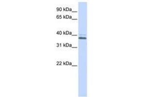 Image no. 1 for anti-ERGIC and Golgi 2 (ERGIC2) (C-Term) antibody (ABIN6740585) (ERGIC2 anticorps  (C-Term))
