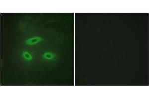 Immunofluorescence analysis of HeLa cells, using NKTR Antibody. (NKTR anticorps  (AA 784-833))