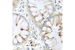 Immunohistochemistry of paraffin-embedded human colon using PI3 antibody (ABIN5974984) at dilution of 1/100 (40x lens). (PI3 anticorps)