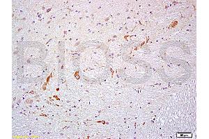 Formalin-fixed and paraffin embedded rat brain labeled with Anti- PROK2/Prokineticin 2 Polyclonal Antibody, Unconjugated (ABIN714701) at 1:200 followed by conjugation to the secondary antibody and DAB staining (PROK2 anticorps  (AA 28-100))