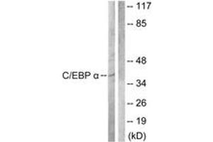 Western Blotting (WB) image for anti-CCAAT/enhancer Binding Protein (C/EBP), alpha (CEBPA) (AA 192-241) antibody (ABIN2888784) (CEBPA anticorps  (AA 192-241))