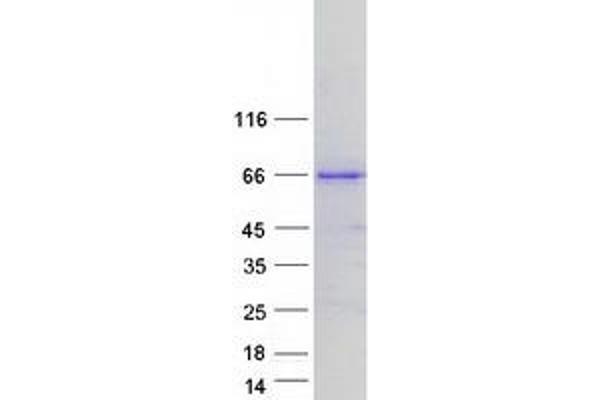 CLCC1 Protein (Transcript Variant 1) (Myc-DYKDDDDK Tag)