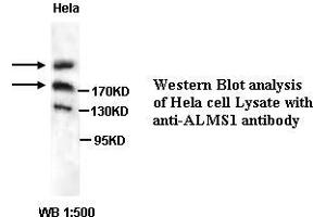 Image no. 1 for anti-Alstrom Syndrome 1 (ALMS1) antibody (ABIN1574631) (ALMS1 anticorps)