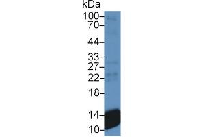 Western blot analysis of Human Platelet lysate, using Human bTG Antibody and HRP-conjugated Goat Anti-Mouse antibody ( (beta-Thromboglobulin anticorps  (AA 59-128))