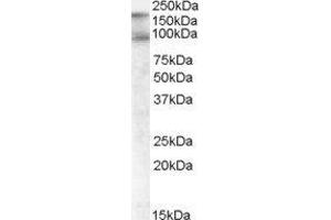 ABIN2561770 (1µg/ml) staining of Human Colon lysate (35µg protein in RIPA buffer). (CDCP1 anticorps  (C-Term, Isoform 1))